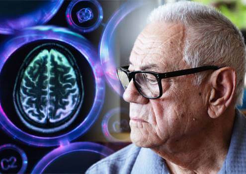 A person with vascular dementia.