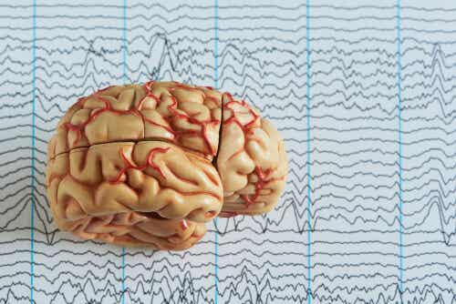 Epileptische hersenen