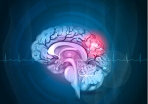 What Exactly Is Chemo Brain?