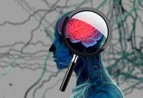 A brain under scrutiny.