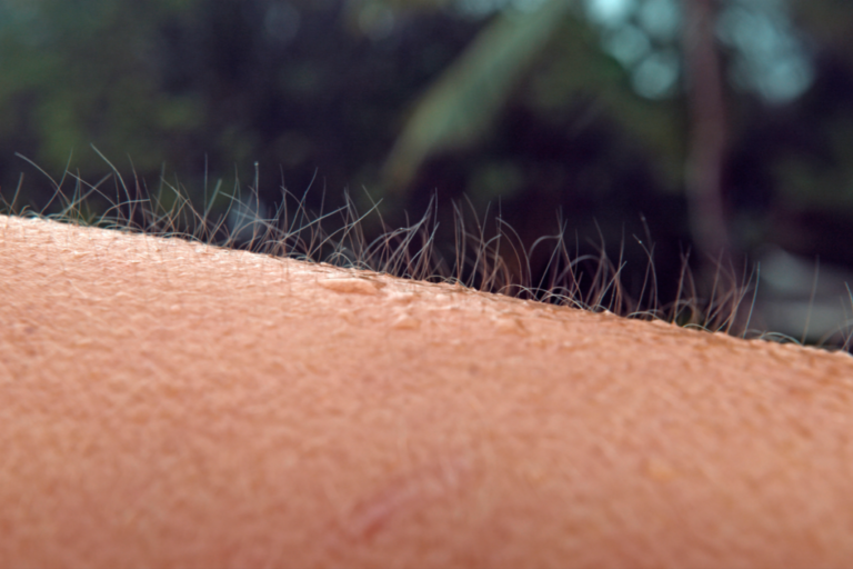Skin Orgasms, When Music Gives You Goosebumps