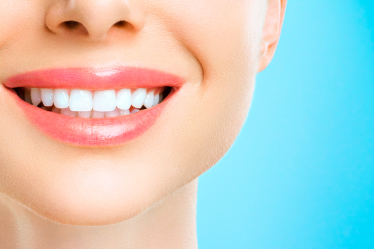 Bleachorexia: The Dangerous Obsession With White Teeth