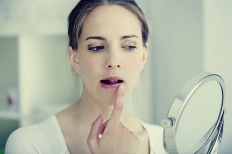 Herpes Due to Stress: Emotions That Turn into Blisters