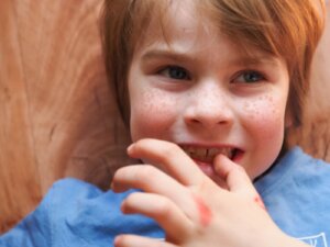 Stimming: Self-Stimulating Behavior in Autism